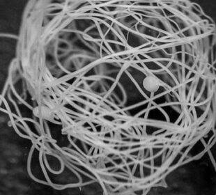 Seda de araña podría sustituir al plástico de un solo uso - Noticias de Ecuador