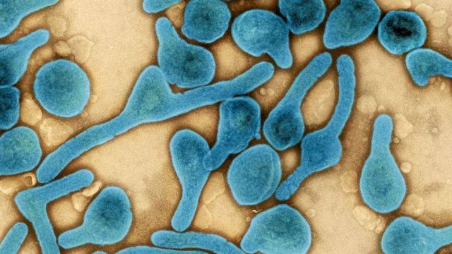 Ghana detecta el virus de Marburgo - Noticias de Ecuador